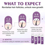 5% Minoxidil Spray for Women-4 PCS ，monoxide for men hair Infused with Biotin, hers hair regrowth treatment, Supports Thicker and Fuller Hair & Beard (13oz, 7 Month Supply)