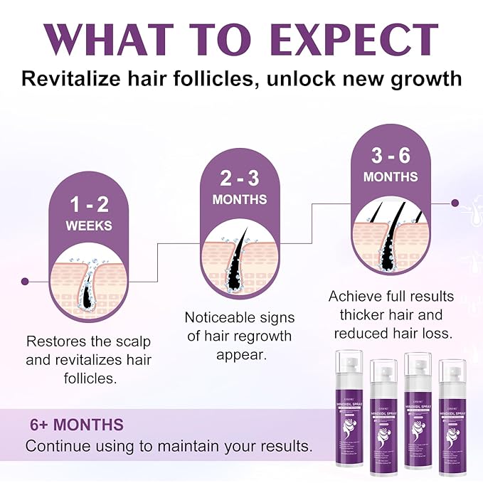 5% Minoxidil Spray for Women-4 PCS ，monoxide for men hair Infused with Biotin, hers hair regrowth treatment, Supports Thicker and Fuller Hair & Beard (13oz, 7 Month Supply)