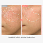 TOSOWOONG Peach 80 Niacin Serum, 5% Niacinamide, Alpha-Arbutin, Vitamin B12, Glass Skin, Hydrating Face Serum for Dark Spots, Pore Minimizer, Uneven Tone, Dullness, Korean Skincare, 33ml/1.11 fl. oz.