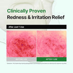 Cicatea Deep Calming Hydrogel Mask, Pore Minimizing with Centella Asiatica, Hydrating Face Mask for All Skin Types, Korean Skincare (35g x 4ea)