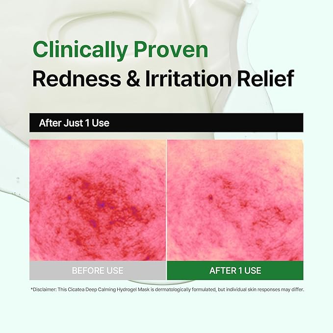 Cicatea Deep Calming Hydrogel Mask, Pore Minimizing with Centella Asiatica, Hydrating Face Mask for All Skin Types, Korean Skincare (35g x 4ea)