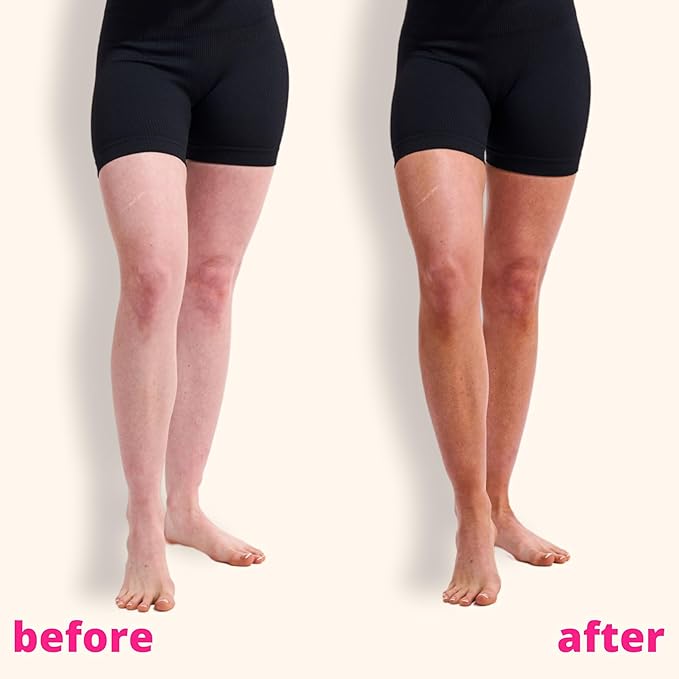 Skinny Tan Self-Tanning Mousse - Long-Lasting and Non-Drying Formula - Coconut and Vanilla Scent - Easy To Apply Luxurious, Foam Texture - Streak Free and Natural Looking Results - Medium - 5 oz