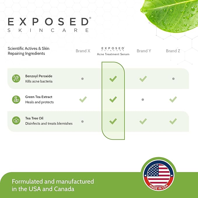 Exposed Skin Care, Acne Treatment Serum with 3.5% Benzoyl Peroxide – Lightweight Acne Spot Treatment – Quickly Clear Teen, Adult, Hormonal and Cystic Acne – Natural, Non-toxic and Cruelty Free