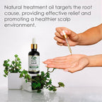 Seddy Itchy Scalp Relief Hair Oil - Scalp Treatment Oil, Instant Soothe, Anti Dandruff with Tea Tree & Peppermint Oil - Relieve Itchy, Dry Scalp - All Hair Types -For Men, Women, & Kids -1.7 Fl. Oz