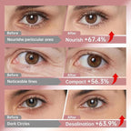 Novoy 7 Pairs Bio-Collagen Real Deep Eye Patches - 6-in-1 Retinol Overnight Eye Patches for Dark Circles, Puffiness & Wrinkles | 2% Caffeine+Hyaluronic+Niacinamide, Korean Popular Eye Mask - ROSE