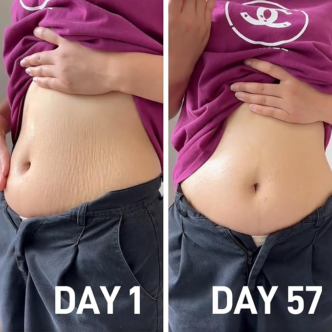 Stretch Mark Oil for Pregnancy & Body Oil for Pregnant Women, Morocco Nut Oil Help for Scars & Stretch Marks Removal & Prevention, Belly Cream for Repair, Firming & Smoothing Fine Lines (2Pack/150ml)