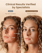 RENPHO Red Light Therapy Mask for Face 2026, Anniversary Christmas Gifts for Women Mom Wife, 324 LEDs Full Face Coverage & 3 Light Modes, Cordless LED Red Light Therapy Face Mask for Home Use & Travel