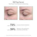 BIOEFFECT EGF Eye Serum with De-Puffer Rollerball, Anti-Aging, Moisturizing Contour Gel To Visibly Reduce Wrinkles, Puffiness, Fine Lines with Barley Growth-Factor Protein