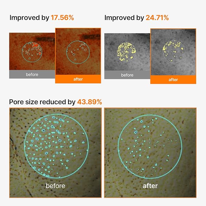 celimax Pore+Dark Spot Brightening Cream Mask 4EA | Non-Sticky Sheet for Enlarged Pores with Niacinamide, Tranexamic Acid, Non-Irritating, Hydrating, Hyperpigmentation, Korean Facial Mask