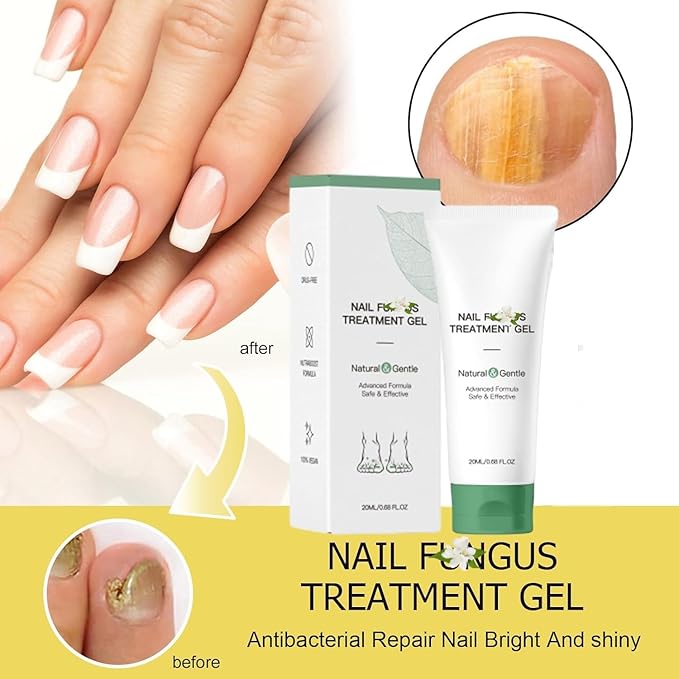 2PCS Nail Repair Gel,Nail Treatment Cream,Multi-Purpose Nail Repair, Nail Growth Serum for Damaged Nail