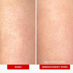 First Aid Beauty KP Bump Eraser Body Scrub with 10% AHA, Keratosis Pilaris Skin Exfoliator with Glycolic and Lactic acids, Helps Reduce Chicken Bumps, Safe for Sensitive Skin, 8 oz