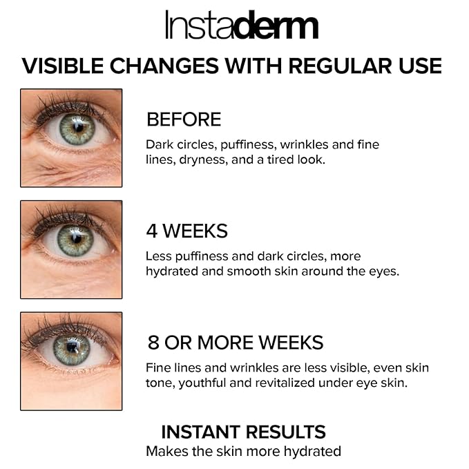 Eye Repair Cream–Reduces the Appearance of Dark Circles, Puffiness, Under Eye Bags, Fine Lines & Wrinkle, Anti-Aging Formula with Niacinamide Visibly Smooth, Brighten, & Hydrate Skin.