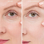 20X Reusable Expression Line Smoothing, Medical-Grade Silicone for Overnight Wrinkle Reduction & Anti-Aging Hydration, Beautify Brow Lift Forehead Anti-Wrinkle Patch