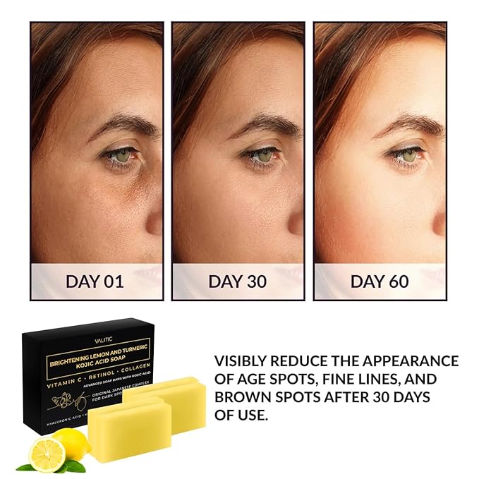 VALITIC Brightening Lemon & Turmeric Kojic Acid Soap with Vitamin C, Retinol, Collagen - Original Japanese Complex Infused with Hyaluronic Acid, Vitamin E, Shea Butter, Castile Olive Oil (4 Pack)