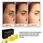 VALITIC Brightening Lemon & Turmeric Kojic Acid Soap with Vitamin C, Retinol, Collagen - Original Japanese Complex Infused with Hyaluronic Acid, Vitamin E, Shea Butter, Castile Olive Oil (4 Pack)