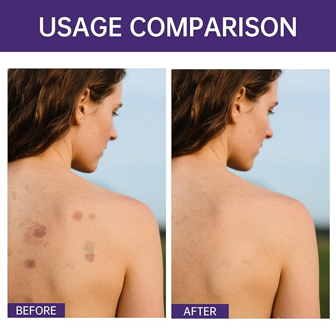 Body Coverage Perfector, Waterproof Leg & Body Makeup for Tattoo & Scar Cover Up, No Transfer Coverage Concealer with Brush, All Over Complexion Perfector for All Skin Tones (Natural Radiance)