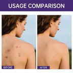 Body Coverage Perfector, Waterproof Leg & Body Makeup for Tattoo & Scar Cover Up, No Transfer Coverage Concealer with Brush, All Over Complexion Perfector for All Skin Tones (Natural Radiance)