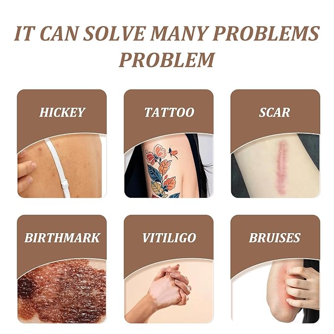 30 Pcs Tattoo Cover Up Patch Waterproof Invisible Non-Woven Tattoo Concealer Tape for Scars, Birthmarks & Tattoos, Ultra Thin Breathable Tatoo Cover Up Stickers