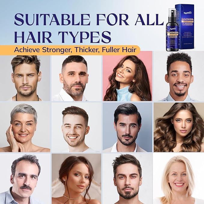 5% Minoxidil Hair Growth for Men and Women: Extra Strength Minoxidil Hair Loss Treatment Serum with Rosemary for Faster Stronger Thicker Hair Growth 2 FL OZ