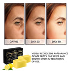 VALITIC Brightening Lemon & Turmeric Kojic Acid Soap with Vitamin C, Retinol, Collagen - Original Japanese Complex Infused with Hyaluronic Acid, Vitamin E, Shea Butter, Castile Olive Oil (5 Pack)