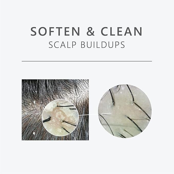 Aromase 5 Juniper Scalp Purifying Liquid Shampoo, 9.1 fluid ounces, Helps to Soften Scalp Buildup, Ideal for Dandruff, Psoriasis, Dermatitis, Dry & Sensitive , Oily hair, Exfoliator