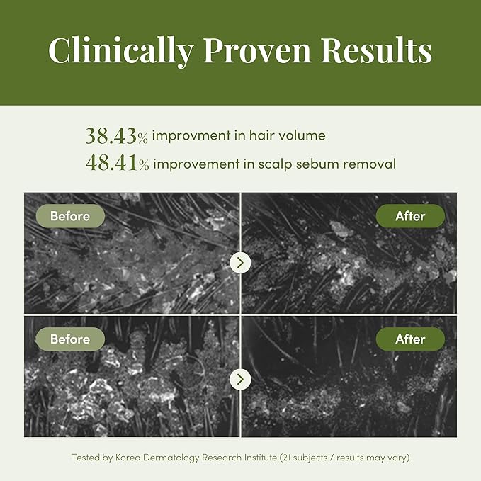 CURLYSHYLL Revitalizing Treatment for Scalp & Hair | Silicone-Free Fortifying Conditioner | Daily Care for Thinning Hair | Citrus Tea Tree | 250ml