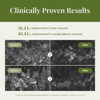 CURLYSHYLL Revitalizing Treatment for Scalp & Hair | Silicone-Free Fortifying Conditioner | Daily Care for Thinning Hair | Citrus Tea Tree | 250ml