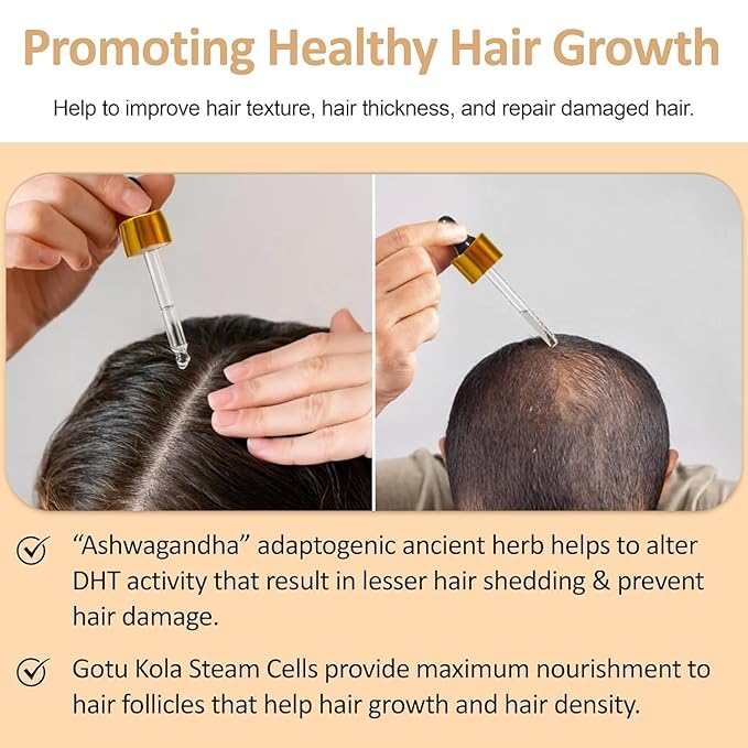 Ultra Restore Hair Growth Serum -Promote Fuller Hair Growth and Reduce Hair Loss, Nurtures Hair Follicle, Hydrates the Scalp, Detox Scalp -Stem Cells, Ashwagandha, Biotin, Keratin