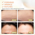 12Pcs Forehead Wrinkle Patches for Women, Hydrolyzed | Collagen | Vitamin E | Aloe Vera to Reduce Wrinkles Forehead Wrinkles Treatment Overnight (White)