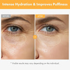 TOSOWOONG VITA Clinic Vitamin Eye Cream, Korean Skincare with 5% Arbutin, 2% Niacinamide, Hyaluronic Acid, Glutathione, Seabuckthorn Eye Serum for Fine Lines & Wrinkles, Puffiness, 15ml / 0.5 fl. oz.