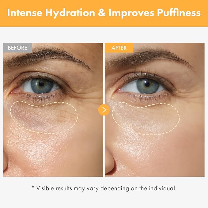 TOSOWOONG VITA Clinic Vitamin Eye Cream, Korean Skincare with 5% Arbutin, 2% Niacinamide, Hyaluronic Acid, Glutathione, Seabuckthorn Eye Serum for Fine Lines & Wrinkles, Puffiness, 15ml / 0.5 fl. oz.