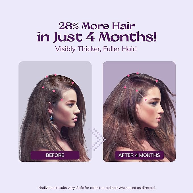 Women's 5% Minoxidil Spray for Hair Growth: 2-Pack RootStim Extra Strength Minoxidil with Rosemary & Biotin for Thinning Hair Regrowth and Fuller Hair - 60ML Each