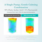 medicube Azelaic Acid Exosome Shot Serum 2000 – Calm Redness due to Dryness while Refining Uneven Texture | Use for After Spot Care, with Azelaic Acid, Niacinamide | Korean Skincare, 30ml / 1.01 fl.oz