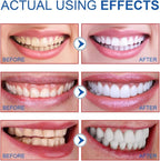 2PCS-SP-6 Whitening Toothpaste, Teeth Whitening, Enamel-Safe, Fluoride-Free, Fresh Mint, Fresh Breath