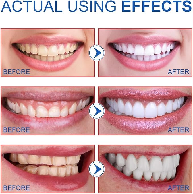 2PCS-SP-6 Whitening Toothpaste, Teeth Whitening, Enamel-Safe, Fluoride-Free, Fresh Mint, Fresh Breath