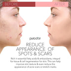 PURA D'OR 4 Oz ORGANIC Rosehip Seed Oil - 100% Pure Cold Pressed USDA Certified Anti-Aging Treatment - Vitamin A & C Rich - Helps Fade Appearance of Scars & Stretch Marks - For Face, Hair & Body