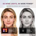 Red Light Therapy for Face – 8 Light Modes with 850nm Near-Infrared, 280 LED Face Mask Light Therapy for Skin Appearance, Fine Lines, Firming Support, FDA Cleared, Cordless Design