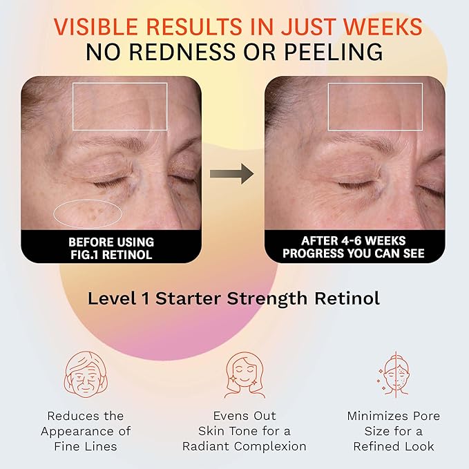 Fig.1 Retinol Night Cream | Face Hydrating Moisturizer With Retinol & Squalane | Night Cream For Women With Sensitive Skin | Dermatologist Tested Wrinkle Reduction | 50ml / 1.7 fl oz