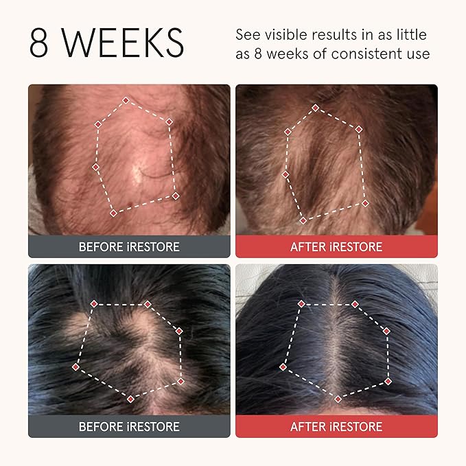 iRESTORE Biotin Hair Conditioner for Damaged Dry Hair - Good for Fine Hair Growth, Volumizing Thickening Conditioner with Ginseng & Argan Oil to Moisturize, Pair With Hair Loss Shampoo