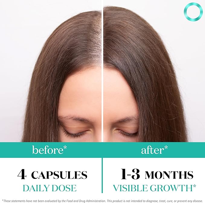Women's Balance Hair Growth Supplements, Ages 45 and Up, Customer Proven for Visibly Thicker Hair and Scalp Coverage, Soy-Free, Made with 26 Ingredients Including Beta Carotenes - 1 Month Supply