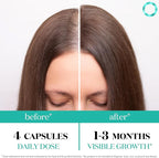 Women's Balance Hair Growth Supplements, Ages 45 and Up, Customer Proven for Visibly Thicker Hair and Scalp Coverage, Soy-Free, Made with 26 Ingredients Including Beta Carotenes - 1 Month Supply