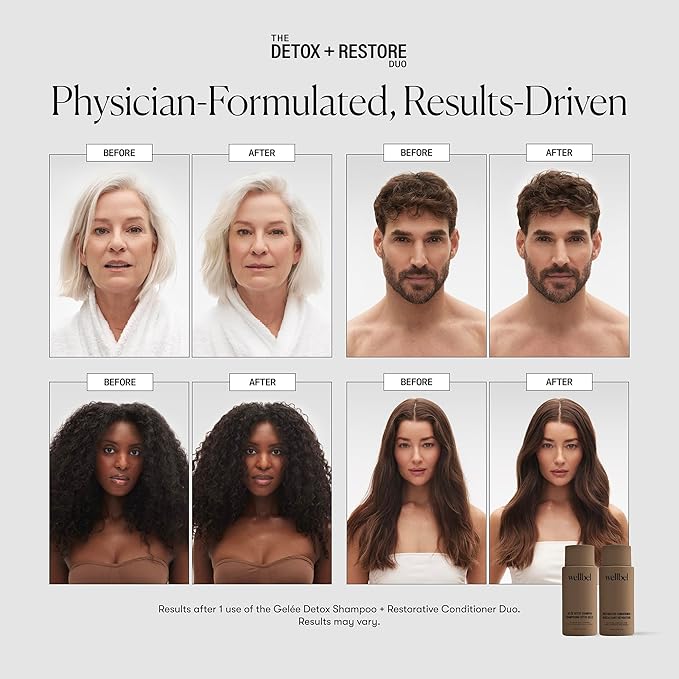 Detox + Restore Duo – Shampoo & Conditioner Set for Scalp Health & Hydration – Microbiome Reset & Frizz Control with Peptides & Hyaluronic Acid (2 x 8.45 oz)