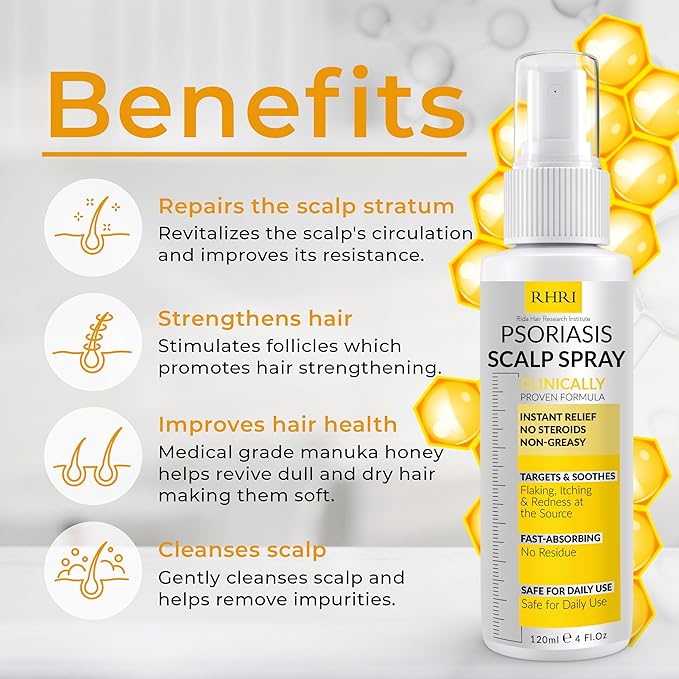 Psoriasis Scalp Spray | Psoriasis and Dandruff Treatment for Scalp Yeast Infections, Psoriasis Flare-Ups & Folliculitis | Antifungal Ringworm Itchy Scalp Spray for Psoriasis, Dryness