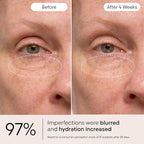 ALPYN Instant Bright Eye with Peptides & Niacinamide | Brightens Dark Circles, Visibly Firms & Softens Fine Lines | 0.5 Fl Oz / 15 ml