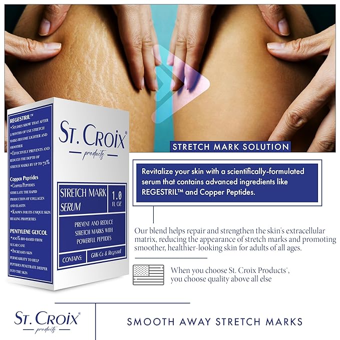 Stretch Mark Serum - Prevent and Reduce Appearance of Stretch Marks - 1 oz