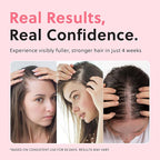 ForChics Hair Growth Serum for Women- Results in 4 Weeks- Hormone Free Hair Regrowth Treatment - For Thinning Hair Loss - Fast Absorbing Non-Greasy Scalp Spray 50ml