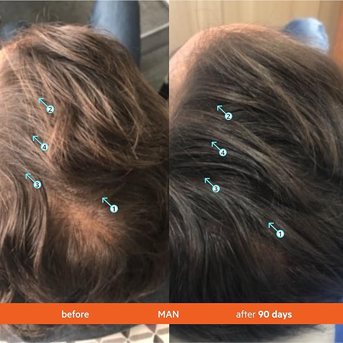 DS Labs Revita Conditioner Refill Pouch, 500 mL – Scalp Refreshing Hydration for Fuller Looking, Weightless Hydration, Caffeine, Turmeric, Sulfate & Silicone Free, Color Safe, For Men & Women