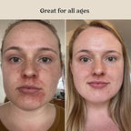 Roe Wellness- Baby Serum Hydrating Skincare EWG Verified Non-Toxic Ingredients Probiotic Protection | Hydrate, Soothe, Safe For All Skin Babies, Infants, Toddlers & Kids (Power Serum)