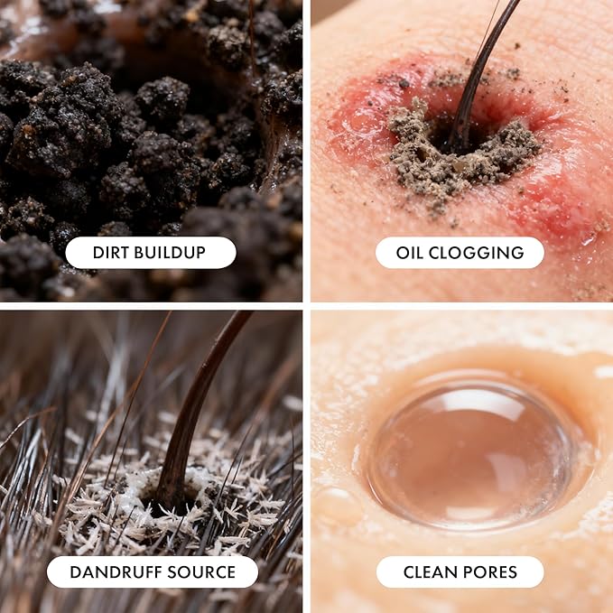 ALFHEIM Rosemary+ Pre-Wash Scalp Oil – Purifying Hair Oil – Hair Treatment and Scalp Clarifying Oil Made with Rosemary Extract – Lightweight Smoothing & Balancing Treatment – Silicone Free – 3.38 oz