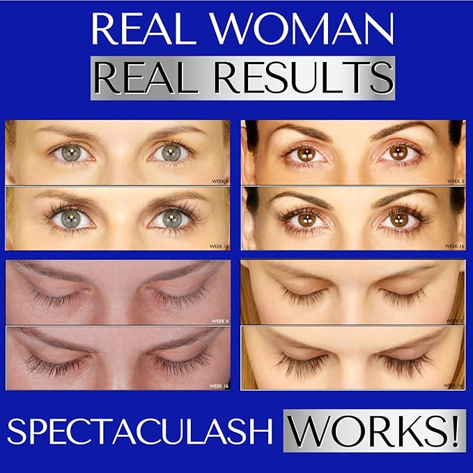 SPECTACULASH XL LASH SERUM for Eyelash Growth - Eyelash Serum to Grow Lashes - Suero para Pestañas Crecimiento - Lash Conditioner for Growth & Volume Lashes - Sérum para Pestañas by DERMAWORKS